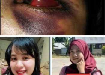 Diduga Penganiayaan Berat di Mopusi, Korban Alami Gangguan Penglihatan, Penanganan Kasus Disorot