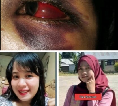 Diduga Penganiayaan Berat di Mopusi, Korban Alami Gangguan Penglihatan, Penanganan Kasus Disorot