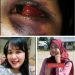 Diduga Penganiayaan Berat di Mopusi, Korban Alami Gangguan Penglihatan, Penanganan Kasus Disorot
